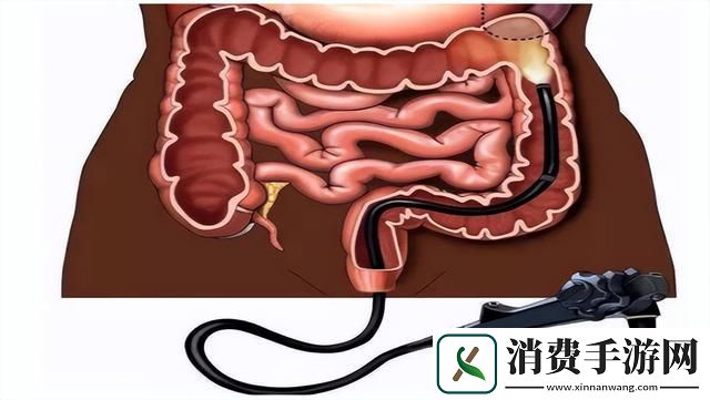 "红液激情：科技狂潮中的大肠冒险"