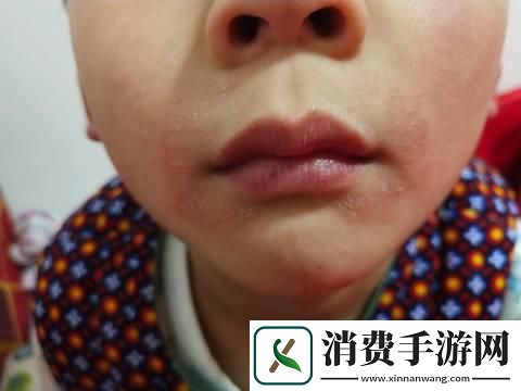 “宝宝湿态硬嘴