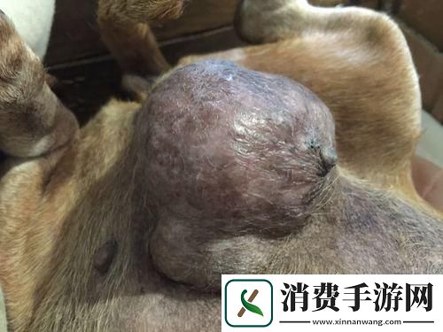 肠道突起拳头大