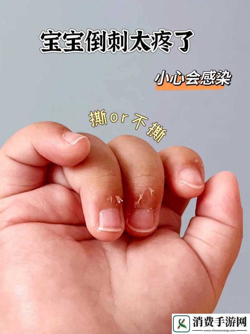 宝宝才三根手指