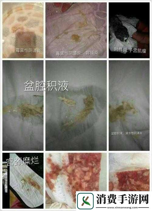 月月我这是帮你排阴毒之真相揭秘