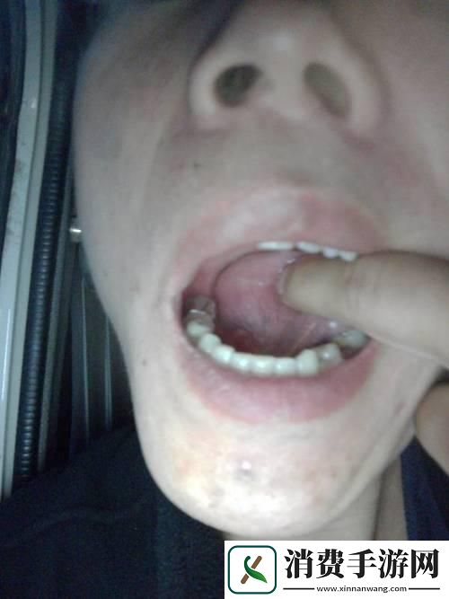 疼痛中绽放的科技奇葩