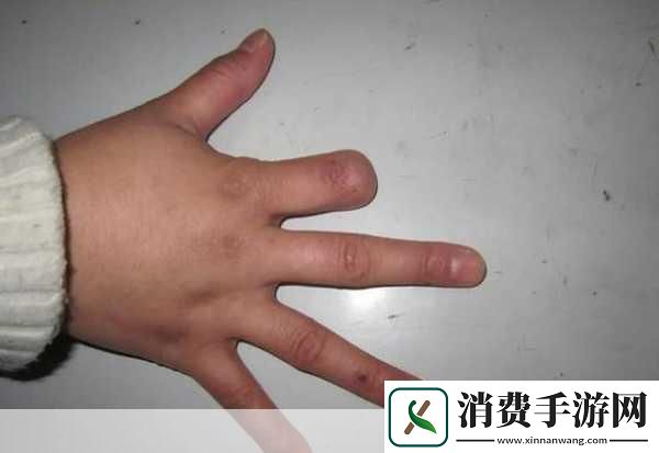 为什么手指划入缝隙挖水