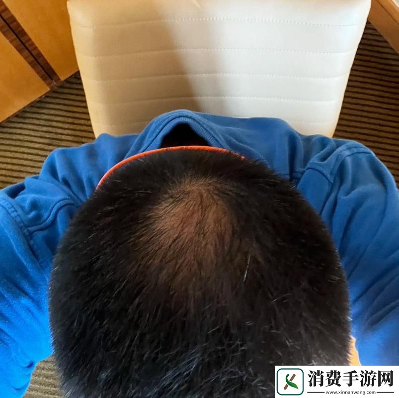 “头发事件”震撼科技圈