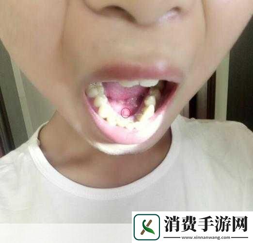 舌头舔到硬包的疼痛感究竟是什么1.