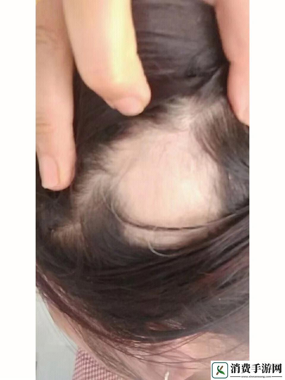 “头发事件”震撼科技圈