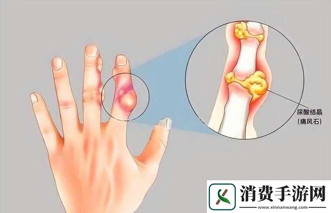 才三根手指就痛