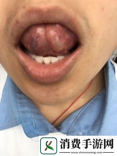 “硬骨头”的秘密