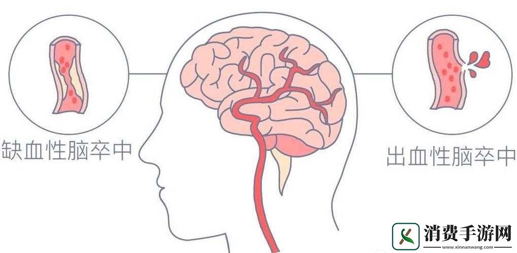 争分夺秒之冠军攻略