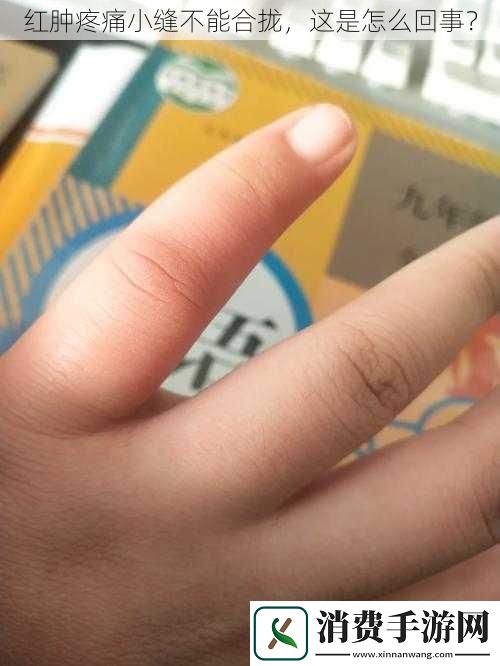 红肿疼痛小缝不能合拢