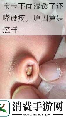 宝宝下面湿透了还嘴硬疼