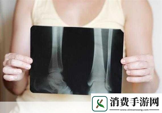 好想C1V1骨科患者的真实反馈