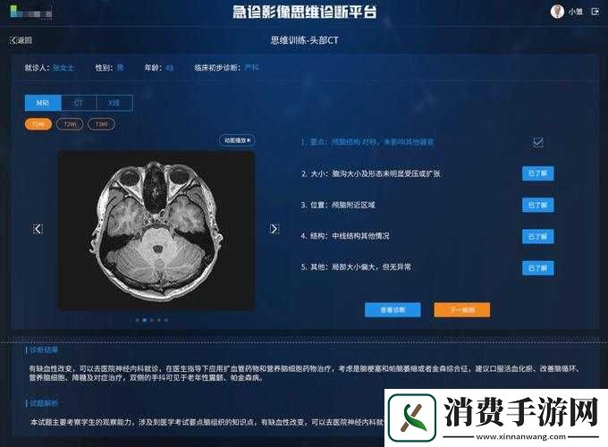 胸片曝光率软件