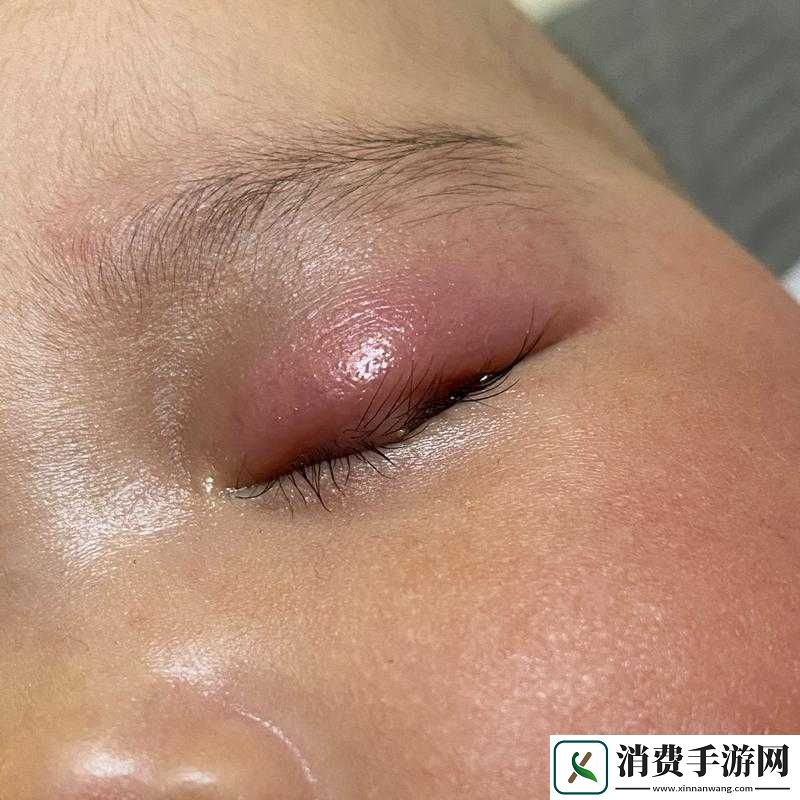 宝宝下面湿透且嘴硬喊疼令人揪心的特殊状况