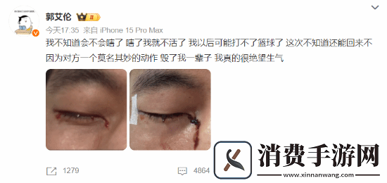 对抗拉满